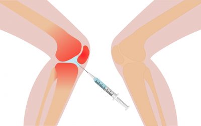 singjoint hyaluronic acid injection for knee pain